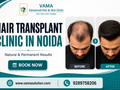 Hair Transplant clinic in Noida