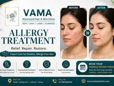 Allergy Treatment